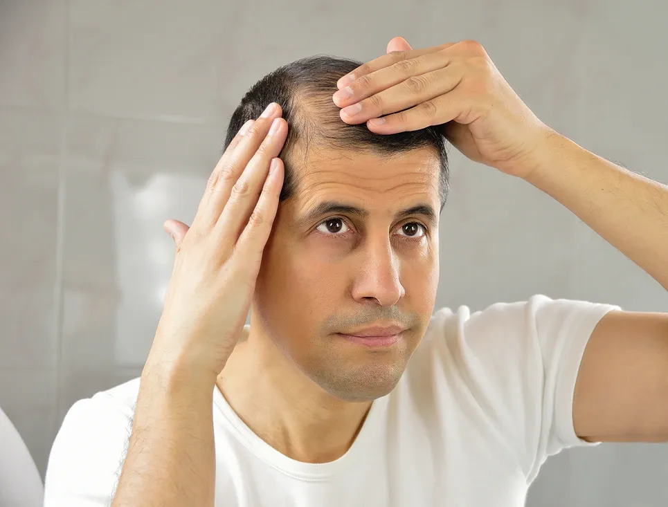 Man examining his receding hairline