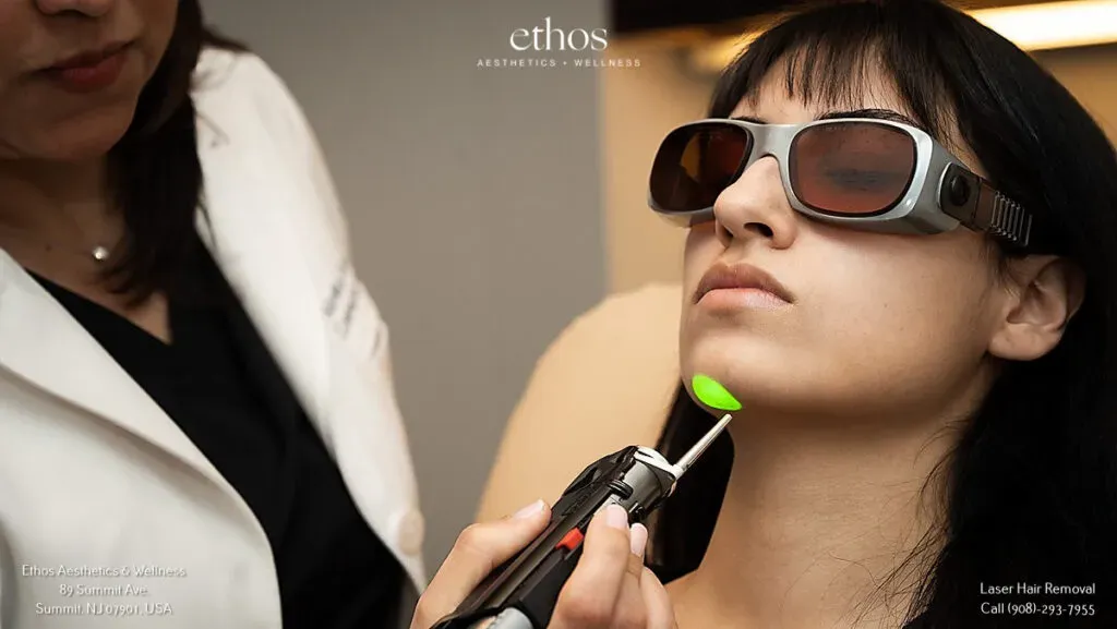 facial laser hair removal at Ethos Spa