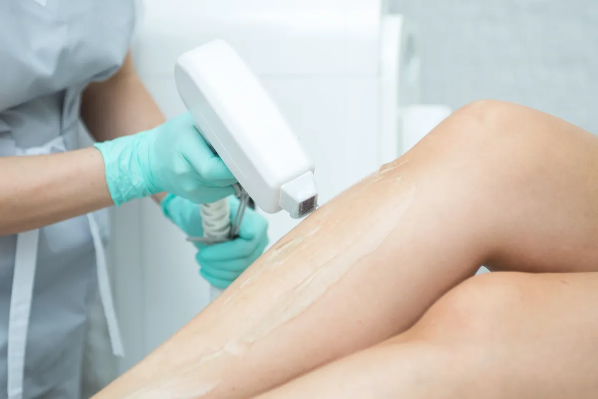 Making Sense of Bruising From Laser Hair Removal