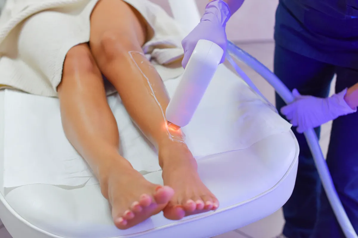 Post-Treatment Guide: How to Handle Bumps After Laser Hair Removal