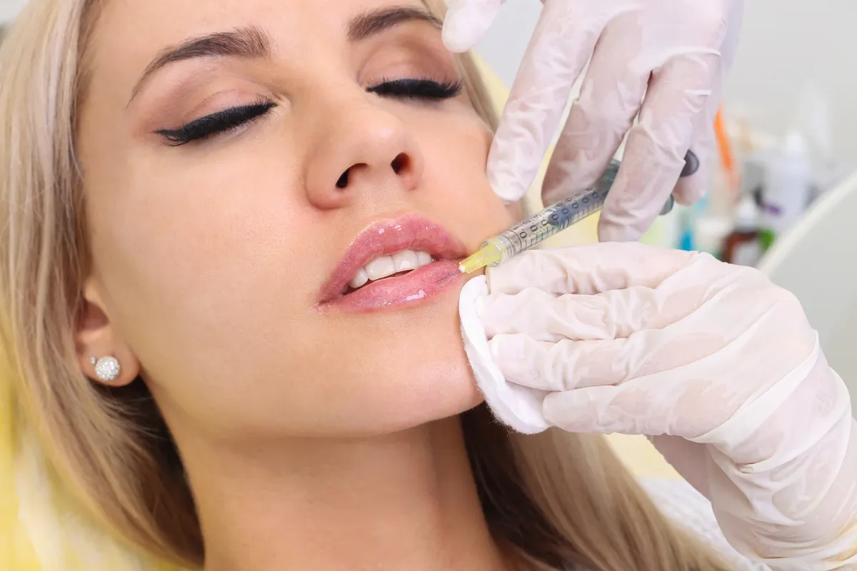 Tackling Lip Filler Lumps and Granulomas