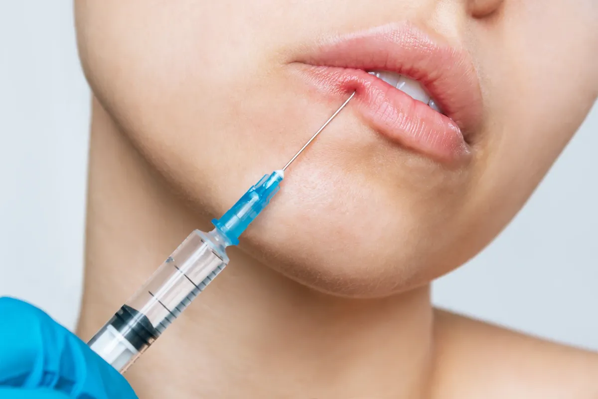 What Happens When Lip Filler Hits a Blood Vessel: A Comprehensive Guide