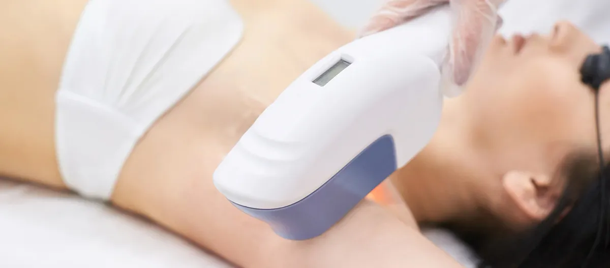 The Truth About RosaCare Laser Hair Removal
