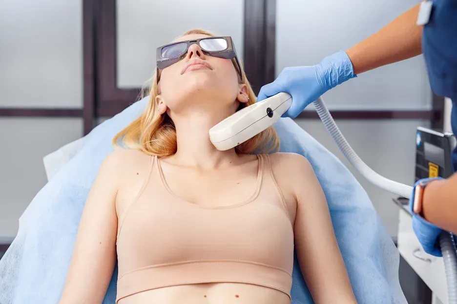 laser hair removal treatment