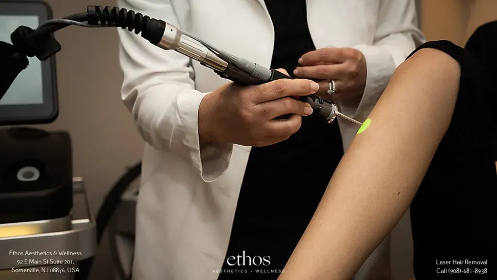 laser hair removal treatment