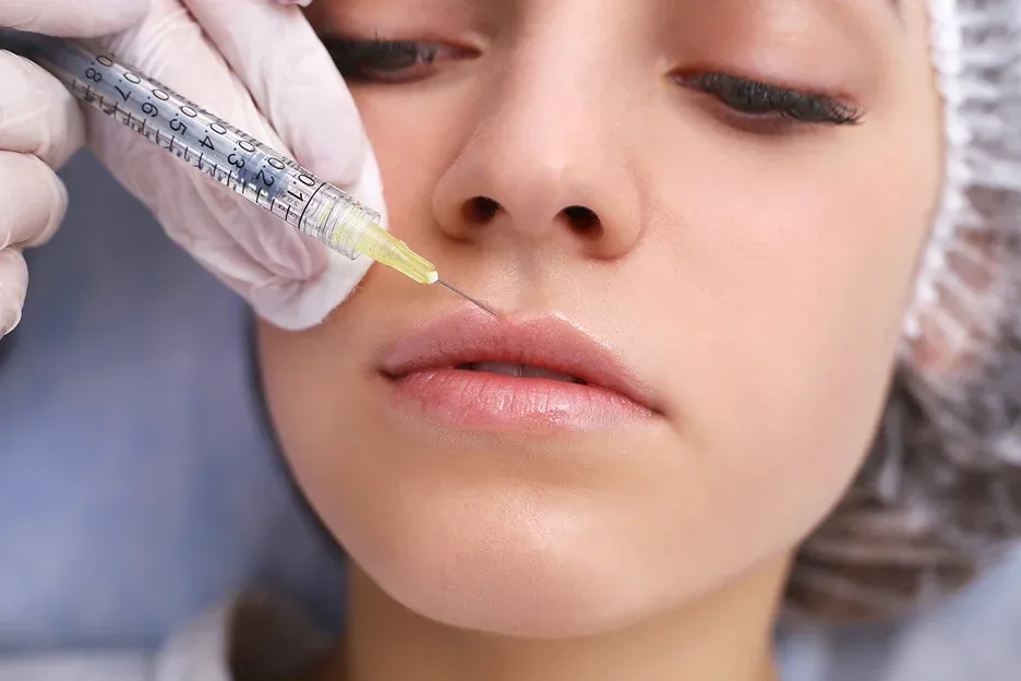 lip filler treatment