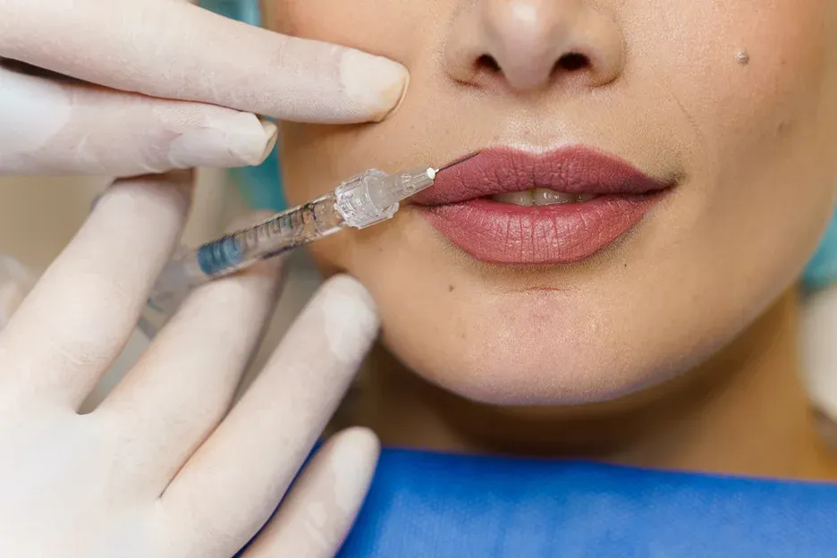lip filler treatment