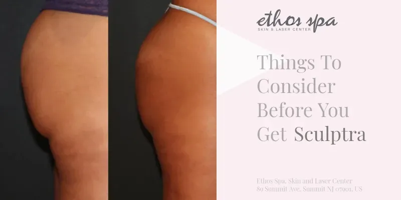 Sculptra buttock before and after with title Things to Consider Before You Get Sculptra