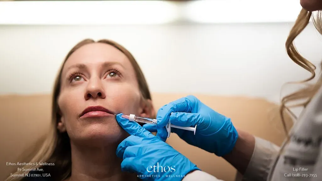 Ethos injector administering lip filler with a fine needle