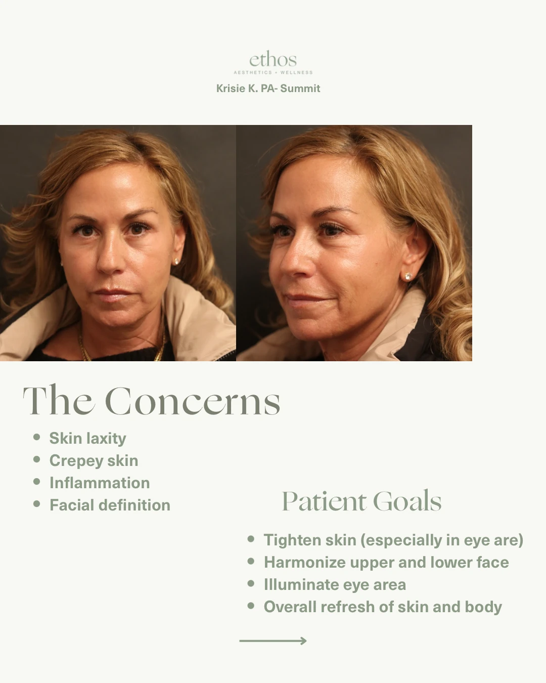 Case study — patient concerns and goals