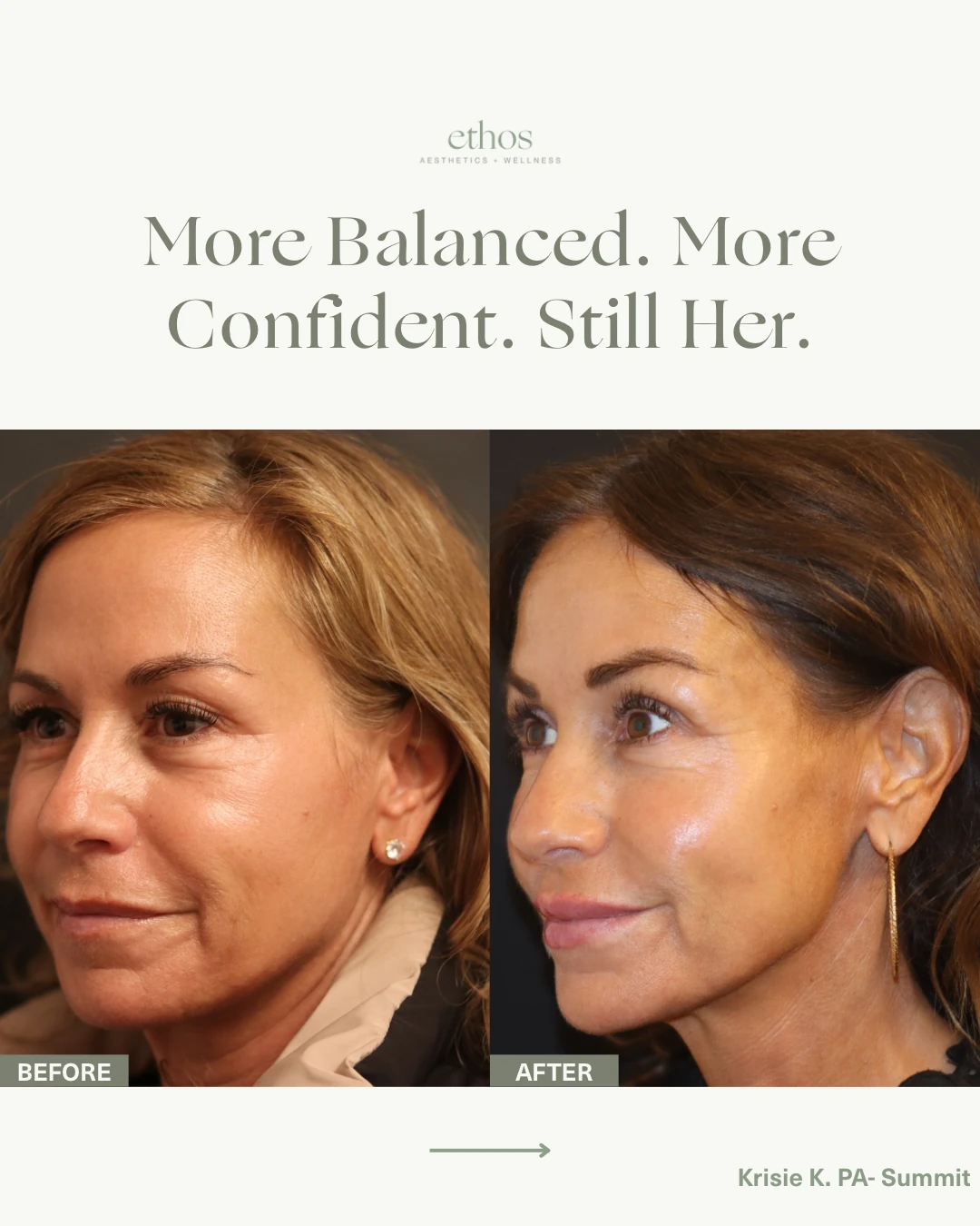 Case study result — more balanced, more confident, still her