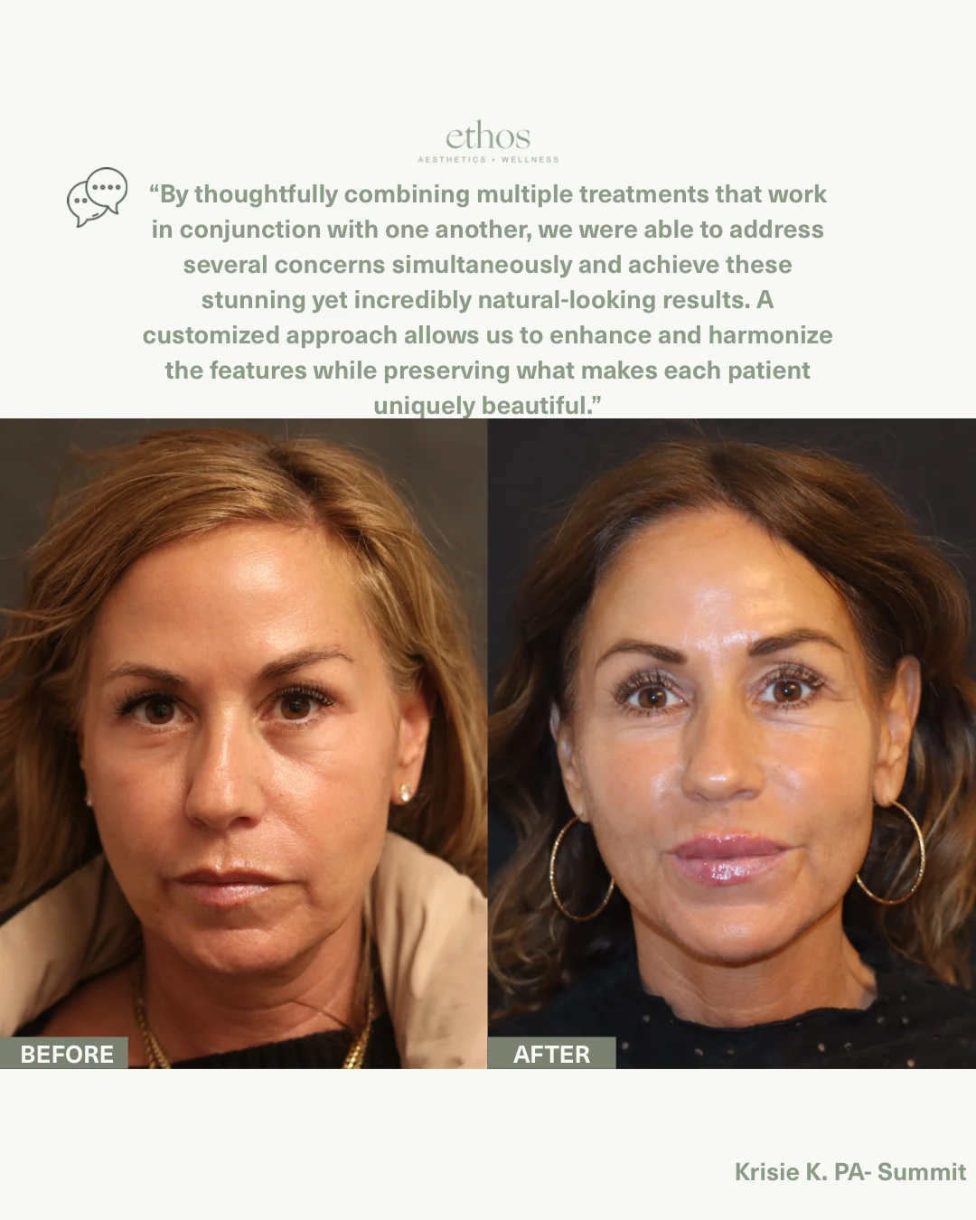 Case study provider quote and final before and after result