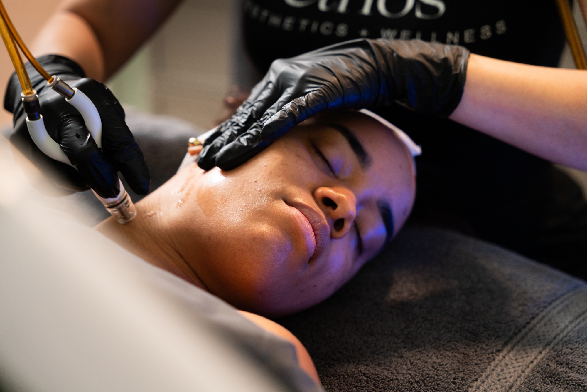 DiamondGlow skin resurfacing treatment