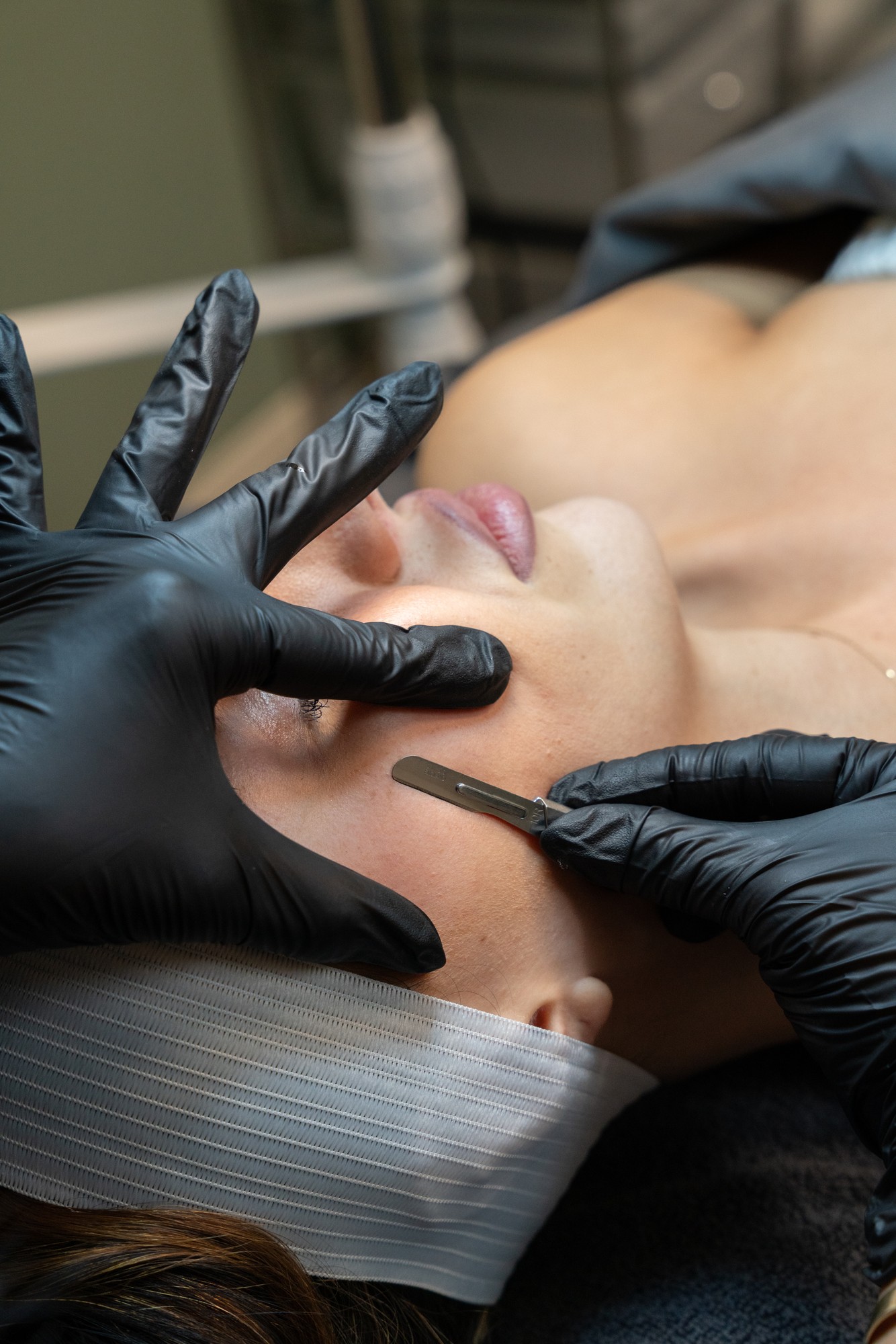 Dermaplaning as part of medical skincare