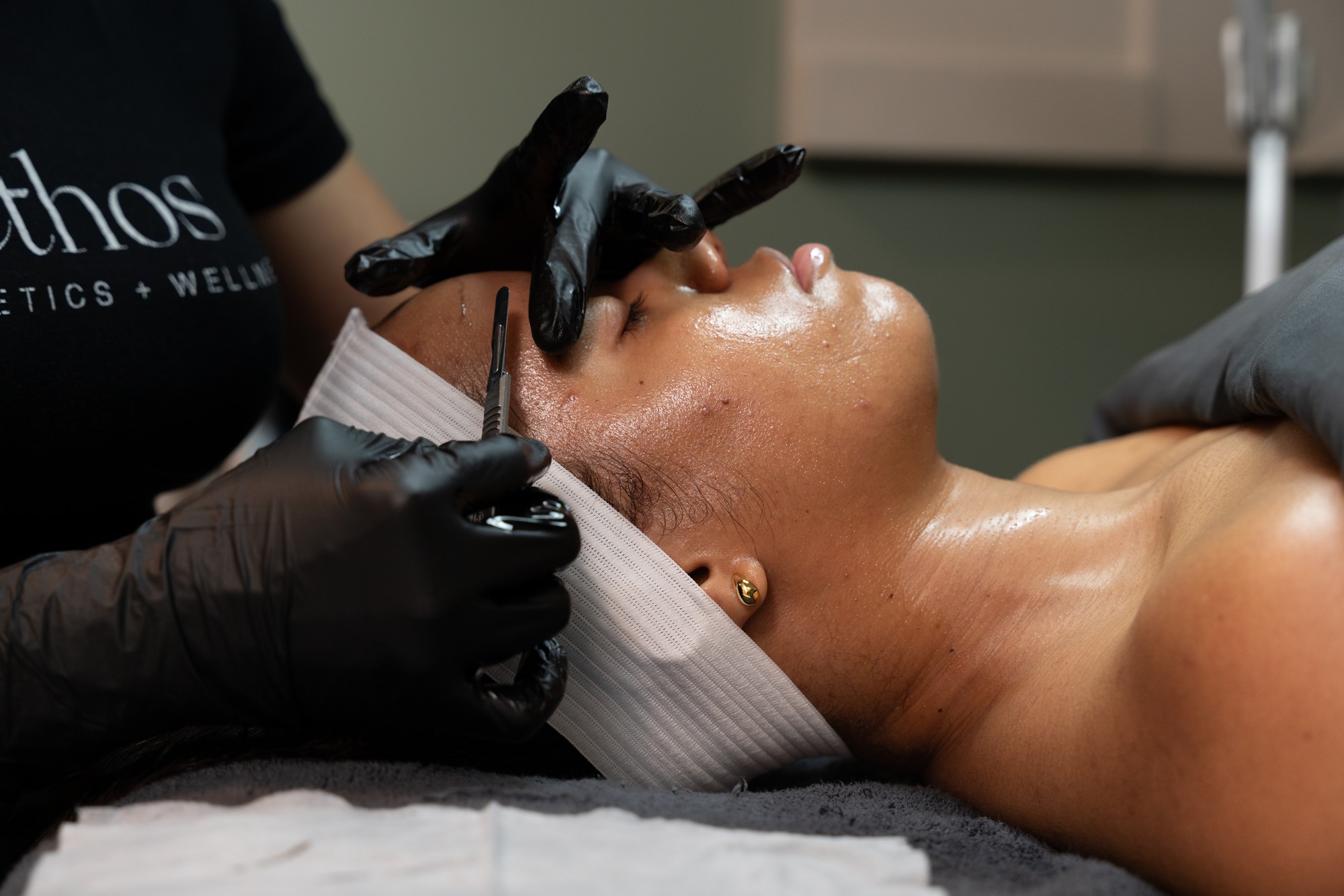 Skin preparation for chemical peel