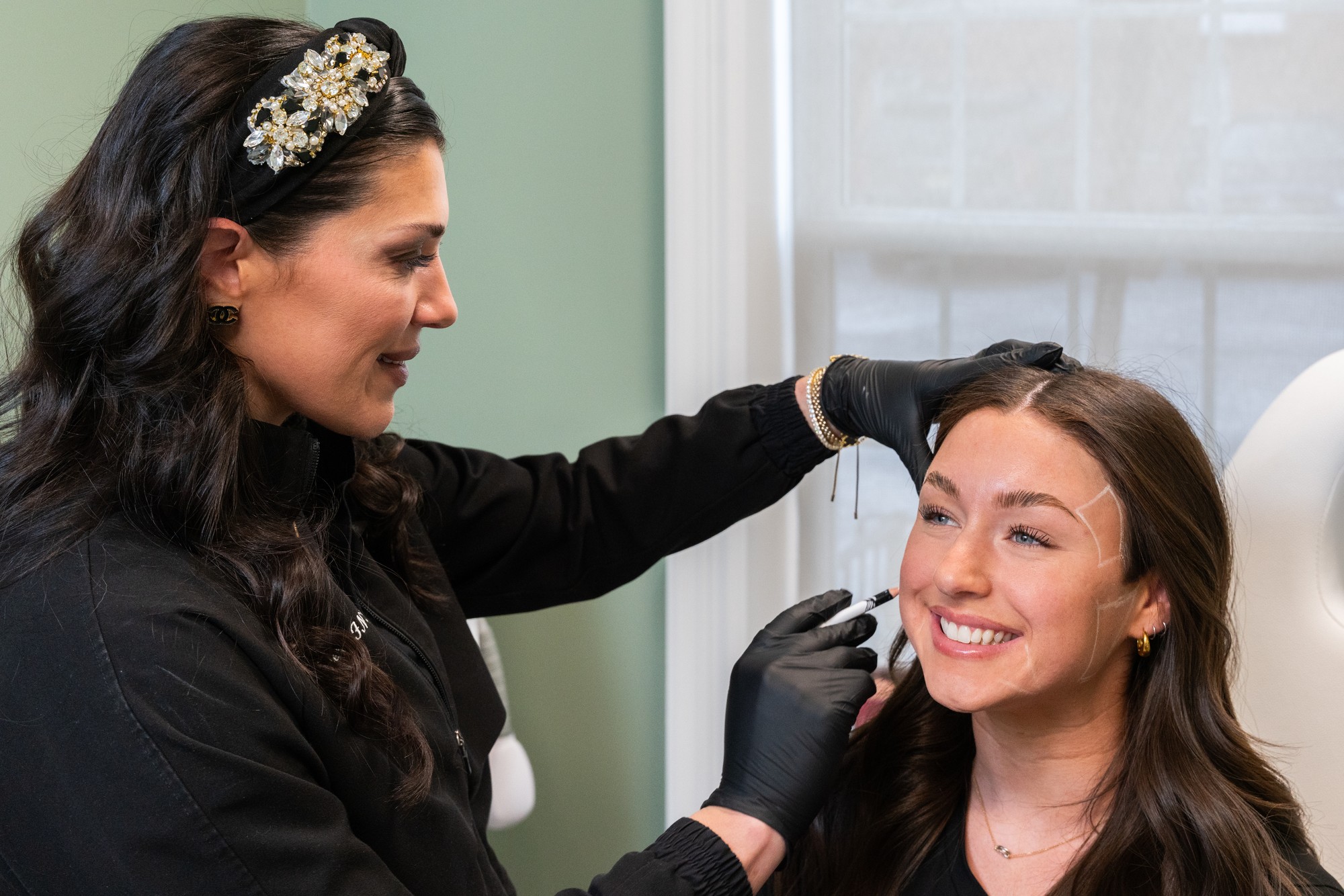 Juvederm cheek volumizing