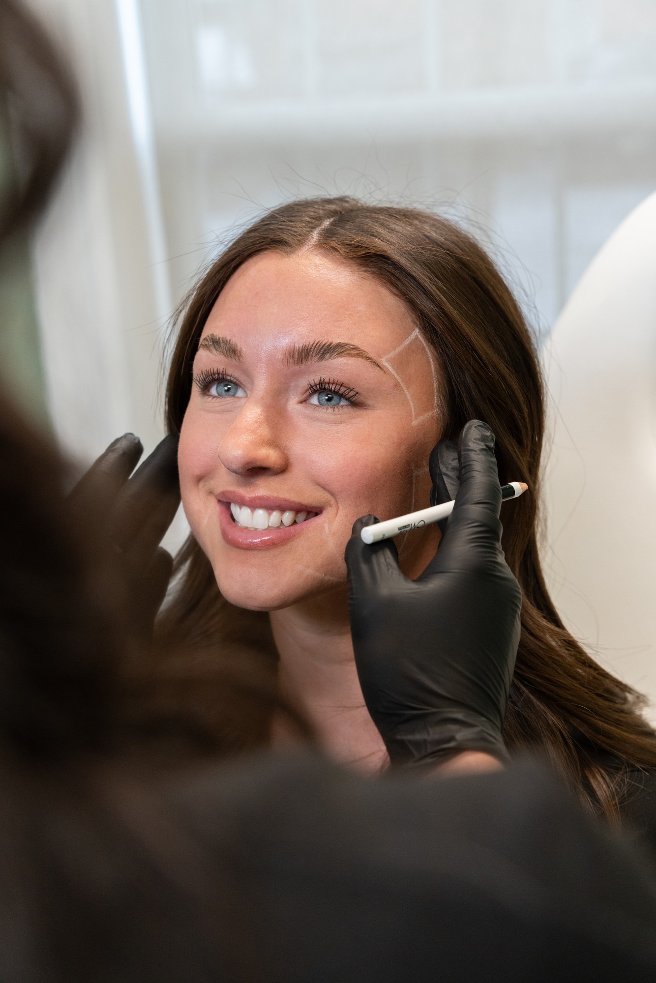 BBL Hero broadband light treatment