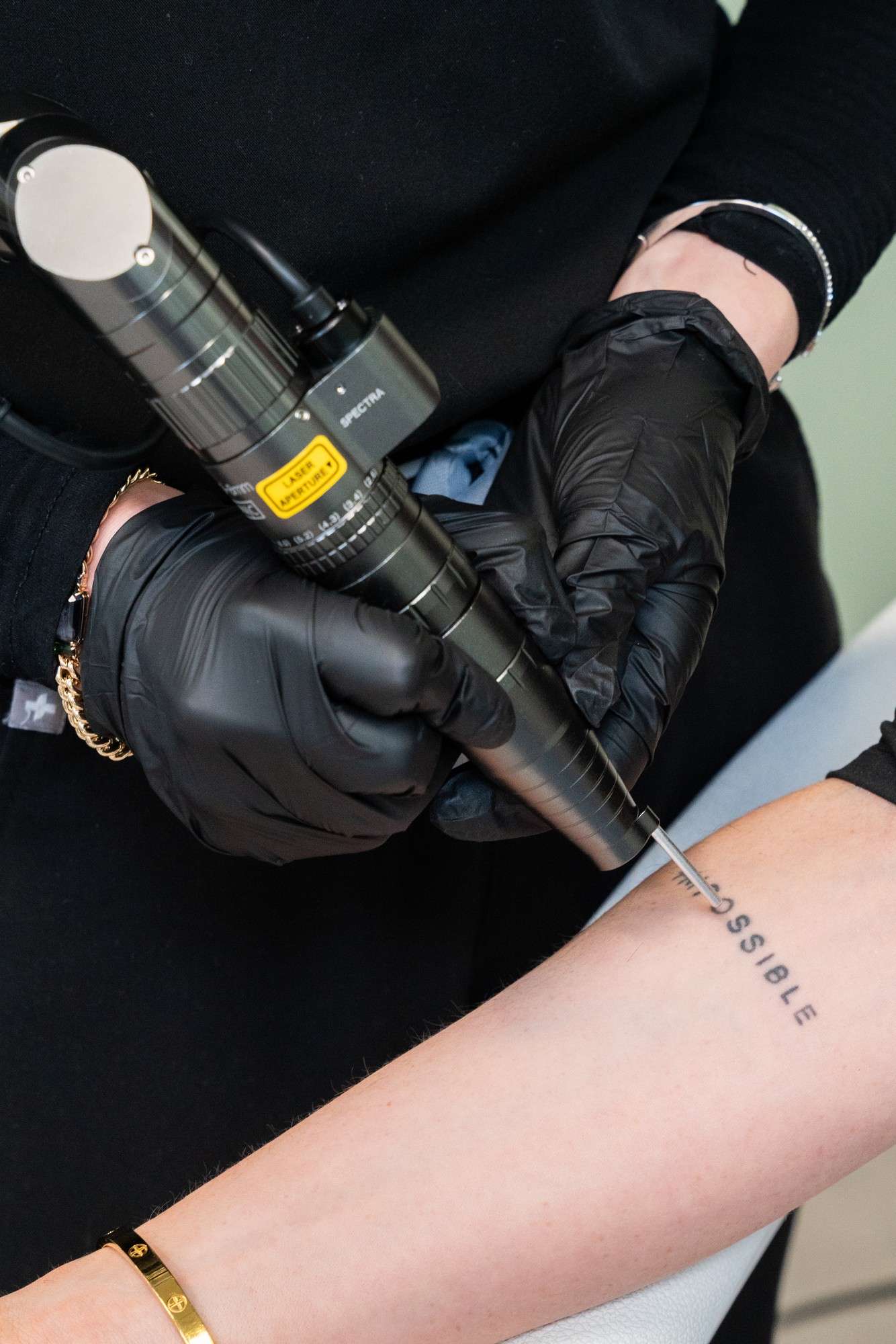 Clarity II dual-wavelength laser session